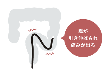 腸が引き伸ばされ痛みが出る