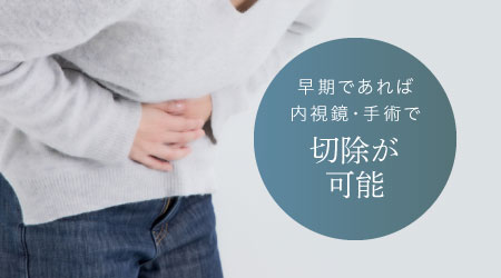 早期であれば内視鏡・手術で切除が可能