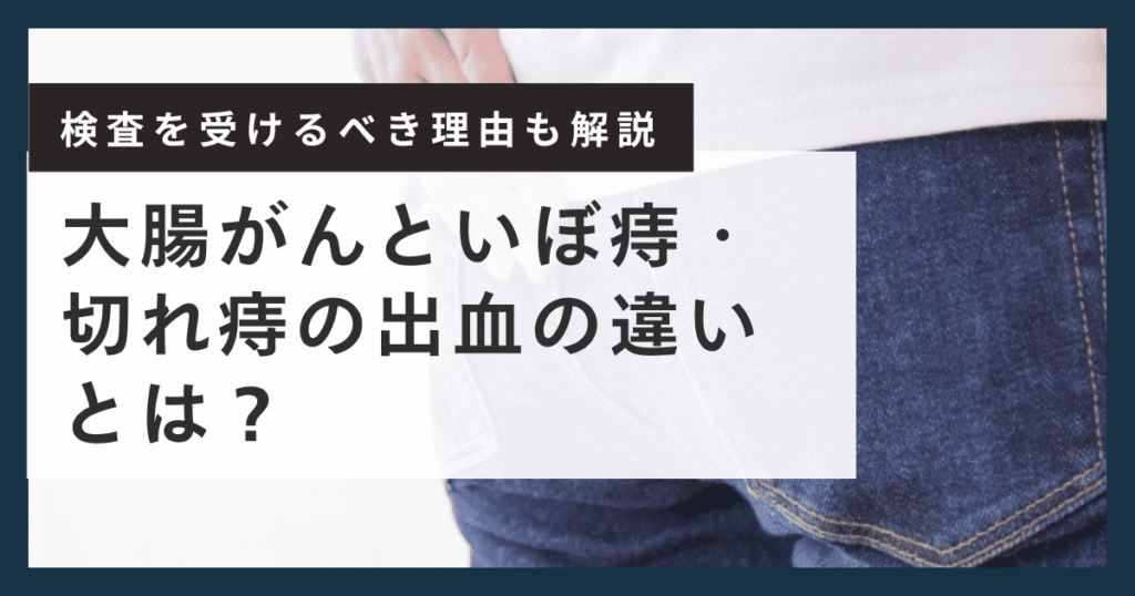 大腸がんと痔の違い